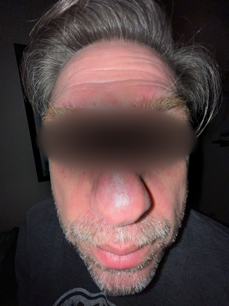 (j) Masked father, collapsed