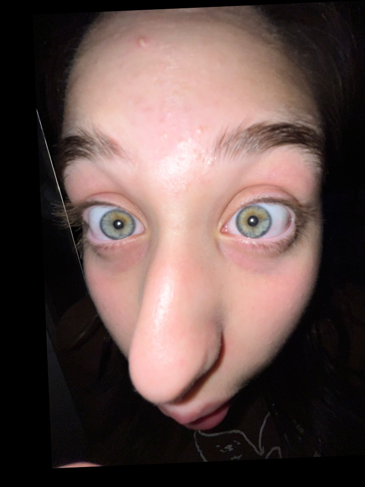 Sister 2 (aligned)