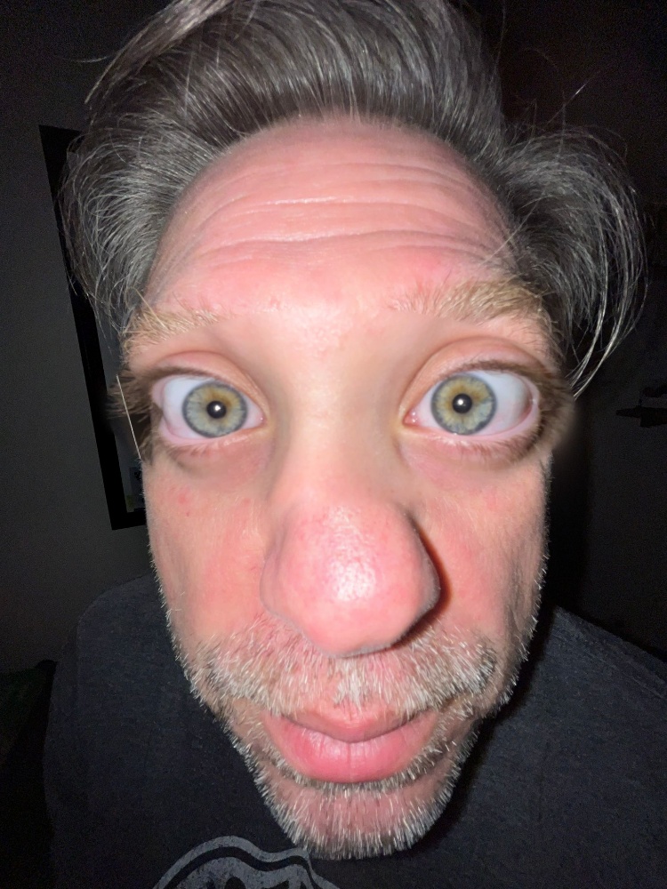 (l) Blended, collapsed
