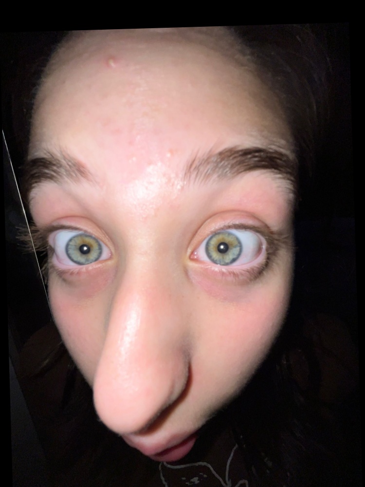 Sister 2 (aligned)
